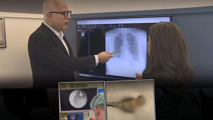 Sabah uyandığında dişleri yoktu! Röntgende gerçek ortaya çıktı