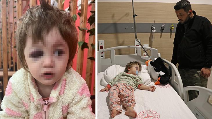 Yalova'da 14 aylık kızı ile birlikte darbedilen babadan yeni açıklama