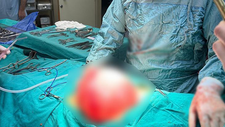 Kilo vermek için hastaneye gitti! 14 yaşındaki çocuğun karnından çıkan şaşkına çevirdi