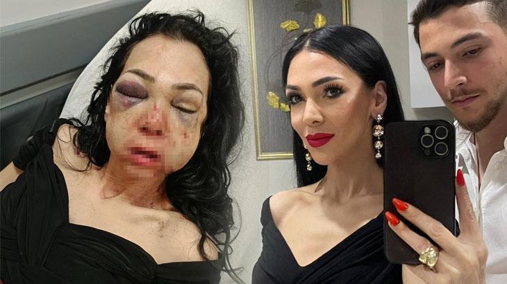 Hayatı bir günde değişti! Kocaeli'de dehşeti yaşayan kadın konuştu: Asla eskisi gibi olamayacağım