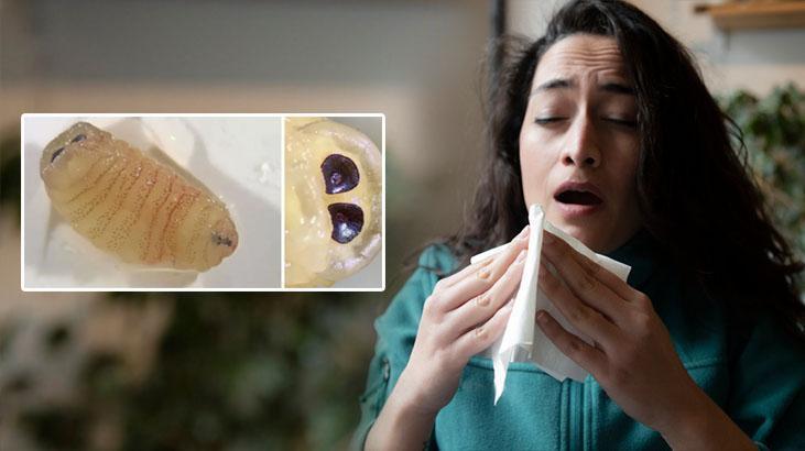 Hapşırdıkça burnundan solucan çıktı! Vücut boşluğunda: 'Biyolojik olarak imkansız'