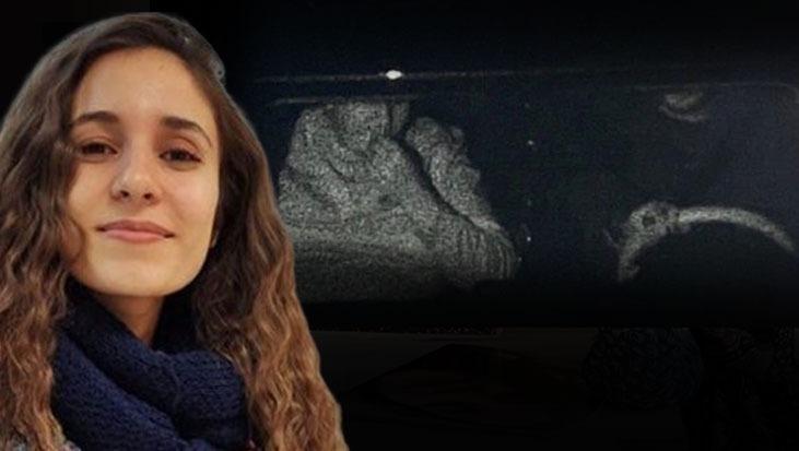 Son dakika: Gülistan Doku dosyasında sarsıcı görüntü! Kayıp SIM kartının izi sürüldü: Silinen 2 isim