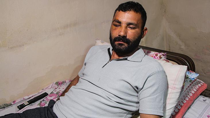 Adana’da işçi 12 metreden düştü! Hayat mücadelesi veriyor: 'Ailemin tek geçim kaynağıydım'