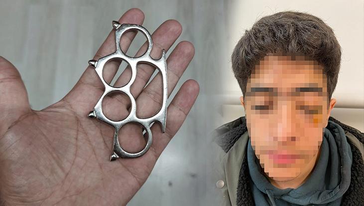 Esenyurt’ta akran dehşeti! Gözünü kaybetme riskiyle ameliyata alınan çocuğun yüz kemikleri kırıldı