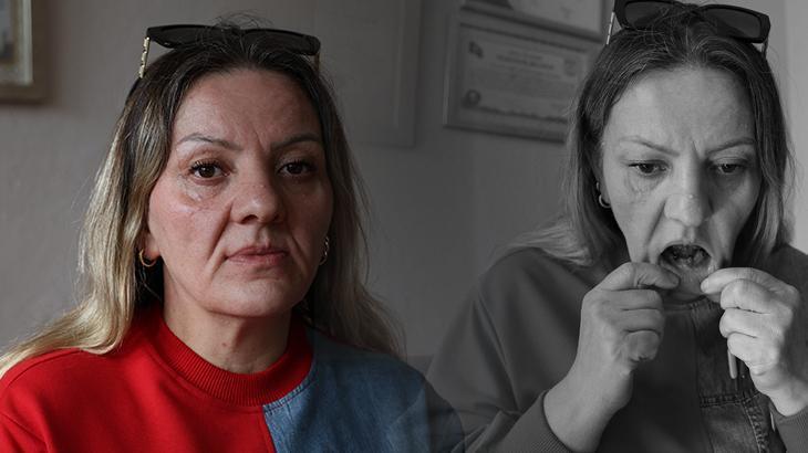 Deliller ağzında çakılı! İspatlamak için iki yıldır yemek yiyemiyor