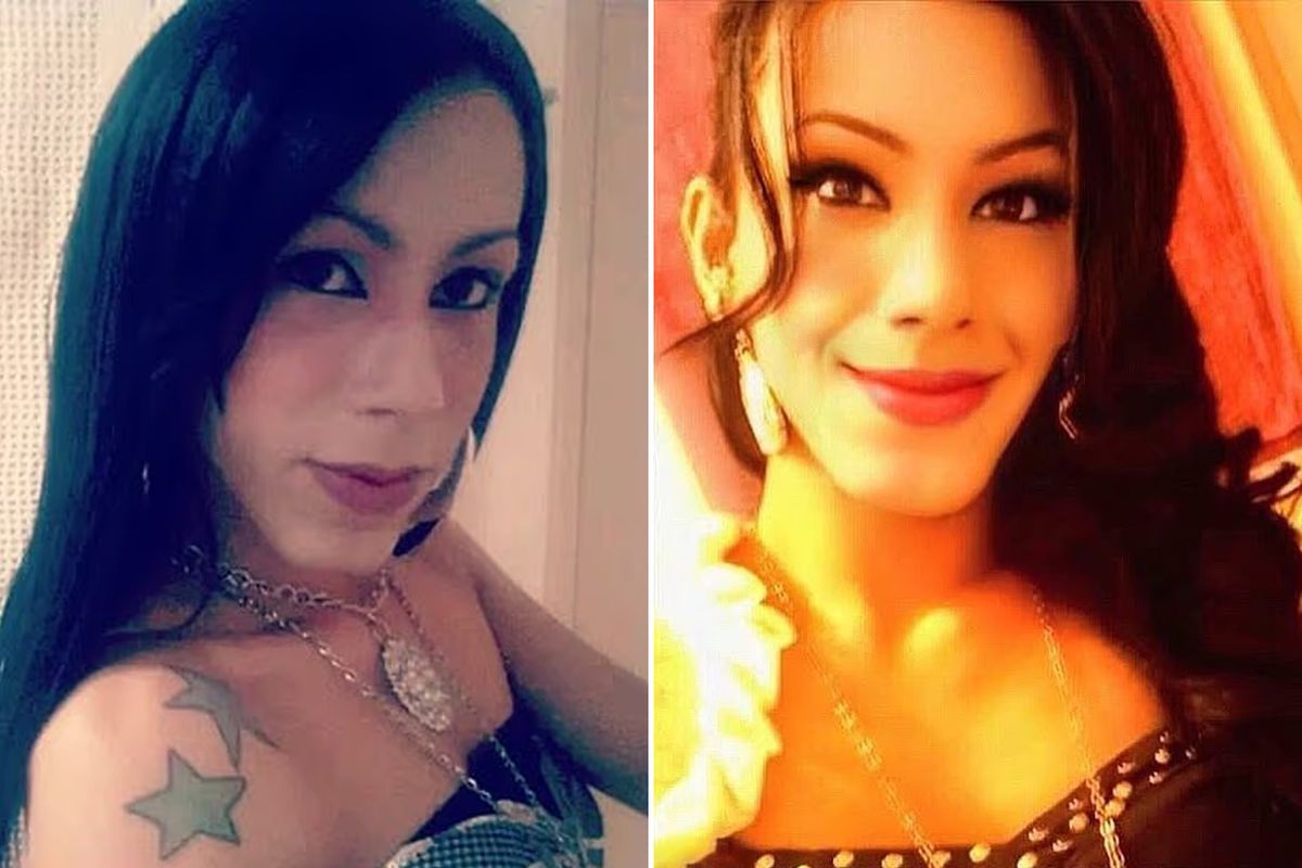 Güzellik uğruna yüzü tanınmaz hale geldi! Yine akıllanmadı